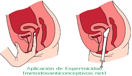 espermicidas