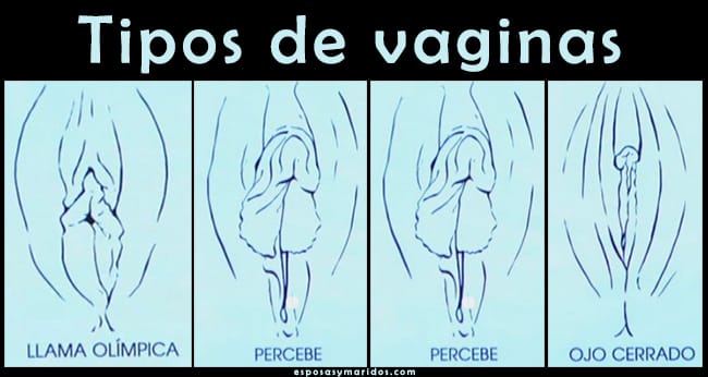 la vagina y los tipos de vaginas